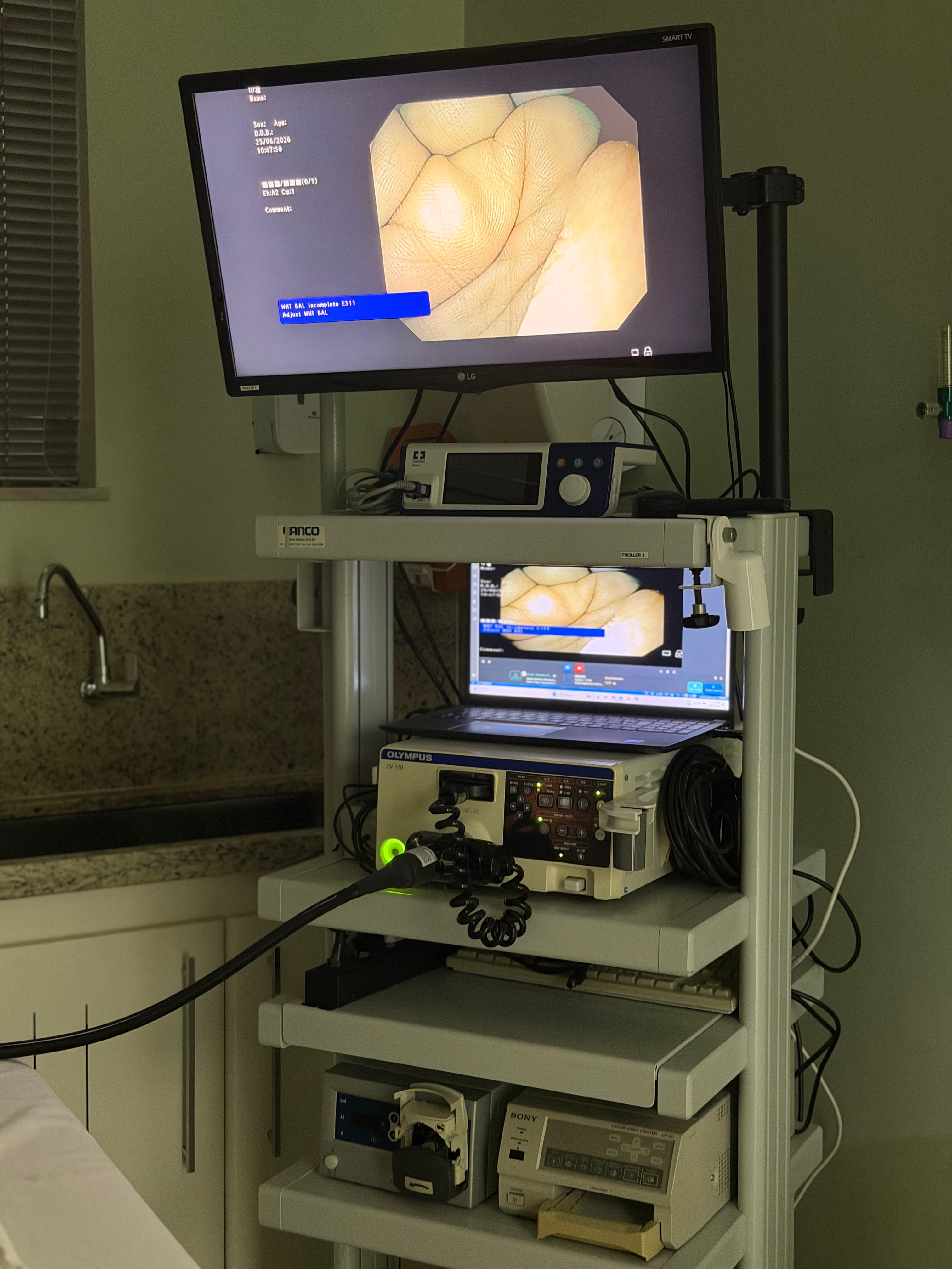Torre de vídeo endoscopia com imagem em 4K